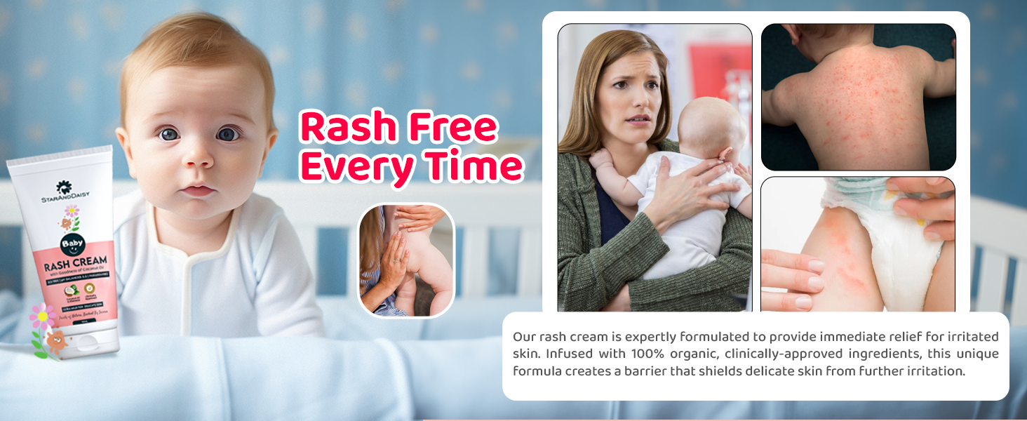 Rash Cream For babies